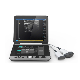 Medical Diagnosis Equipment Laptop Color Doppler Ultrasound Scanner