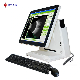  CAS-2000d China Ophthalmic Equipment Ophthalmology Ultrasound Ab Scanner a B Scan with Built-in Computer