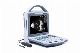 Eyes Hospital Instrument Ophthalmic Ultrasound Scanner a/B Scanner