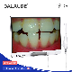 Professional Dentist Assistant Dental Digital Camera Recording Oral Situation