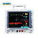  Shinova 12.1 Inch Touchscreen Multi-Parameter Veterinary Monitor with Etco2 for Veterinary Hospital Use