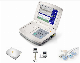 10.4 Inch Hospital Baby Heartbeat Monitoring Doppler High-Tech Fetal Monitor Price